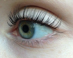 Patient after eyelash lift