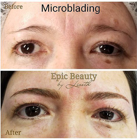 Patient before and after microblading and eyebrow tattooing