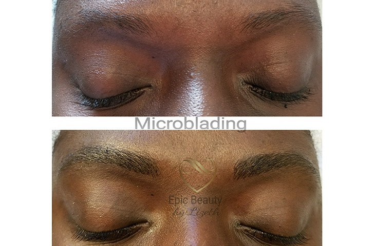Closeup of patients eyebrows before and after microblading